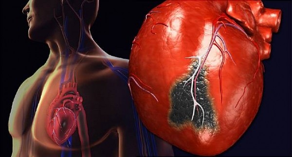 Врачи обнаружили шокирующие изменения в сердце умерших от COVID-19